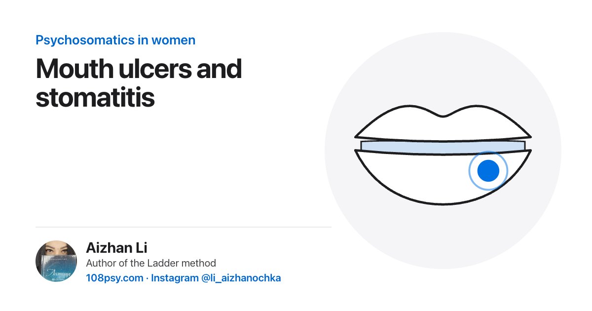 Psychosomatics of stomatitis and mouth ulcers: explained by Aizhan Li, author of the Ladder method