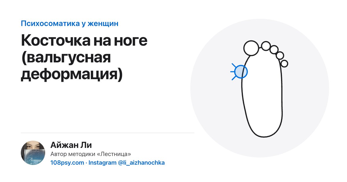 Психосоматика косточки на ноге: разбор Айжан Ли, автора методики «Лестница»